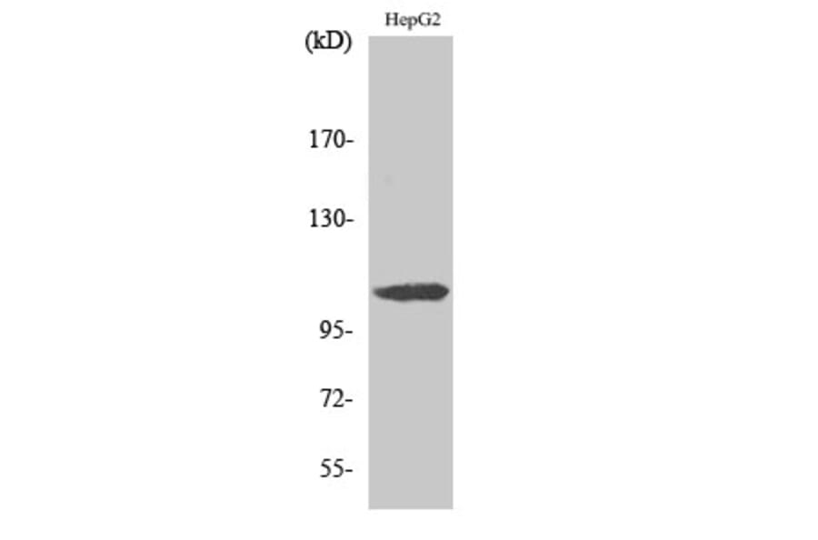 Western blot - ERAP1 Polyclonal Antibody from Signalway Antibody (40897) - Antibodies.com