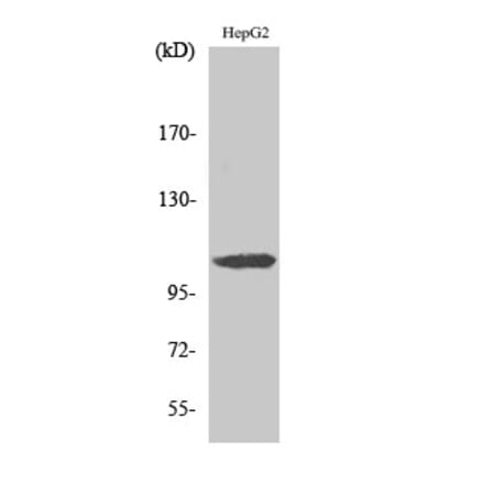 Western blot - ERAP1 Polyclonal Antibody from Signalway Antibody (40897) - Antibodies.com