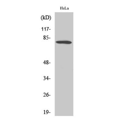 Western blot - FoxO1 Polyclonal Antibody from Signalway Antibody (40934) - Antibodies.com