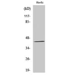 Western blot - GALK1 Polyclonal Antibody from Signalway Antibody (40948) - Antibodies.com