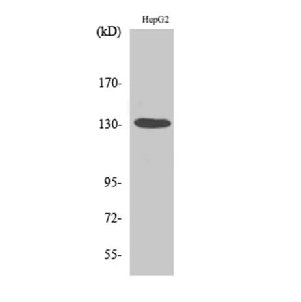 Western blot - HDAC6 Polyclonal Antibody from Signalway Antibody (40999) - Antibodies.com