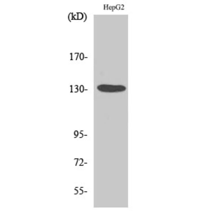 Western blot - HDAC6 Polyclonal Antibody from Signalway Antibody (40999) - Antibodies.com