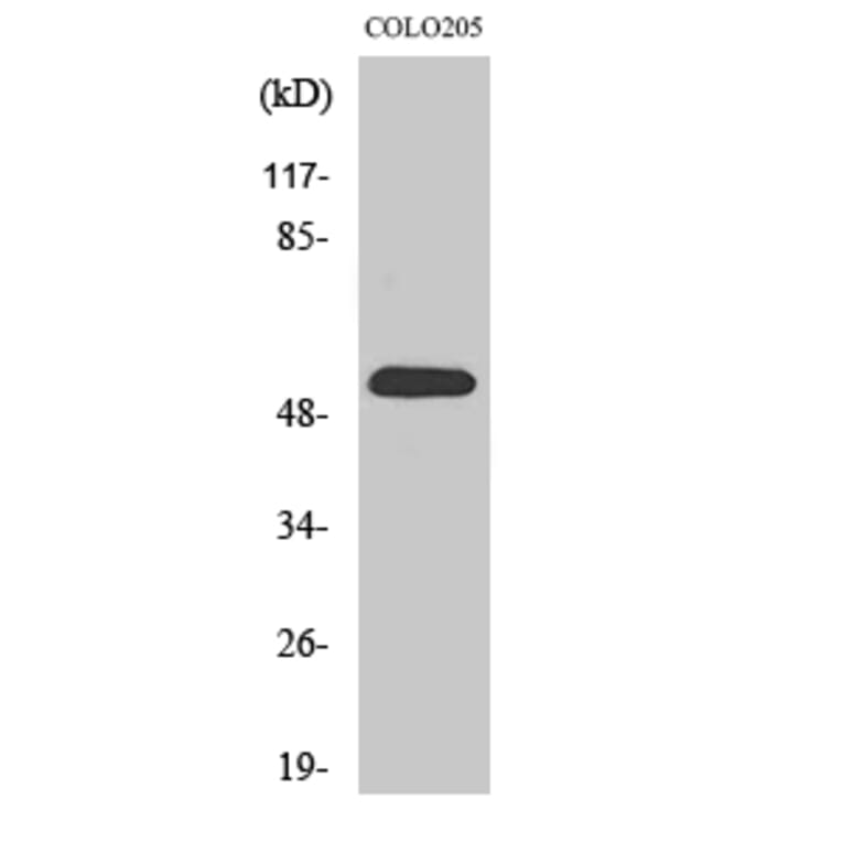 Western blot - HisRS Polyclonal Antibody from Signalway Antibody (41006) - Antibodies.com