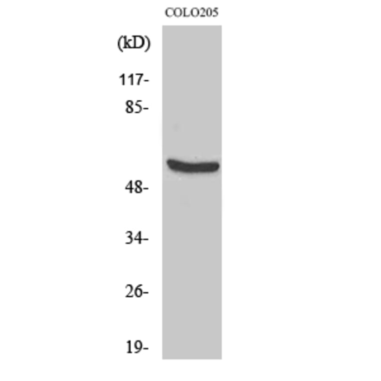 Western blot - HSP60 Polyclonal Antibody from Signalway Antibody (41046) - Antibodies.com