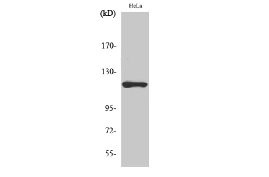 Western blot - HXK I Polyclonal Antibody from Signalway Antibody (41049) - Antibodies.com
