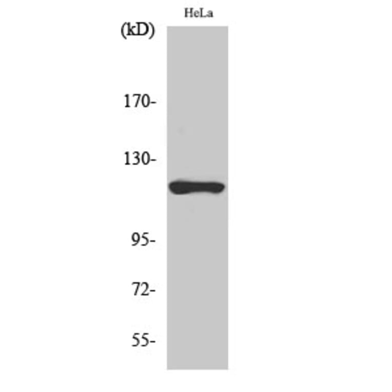 Western blot - HXK I Polyclonal Antibody from Signalway Antibody (41049) - Antibodies.com