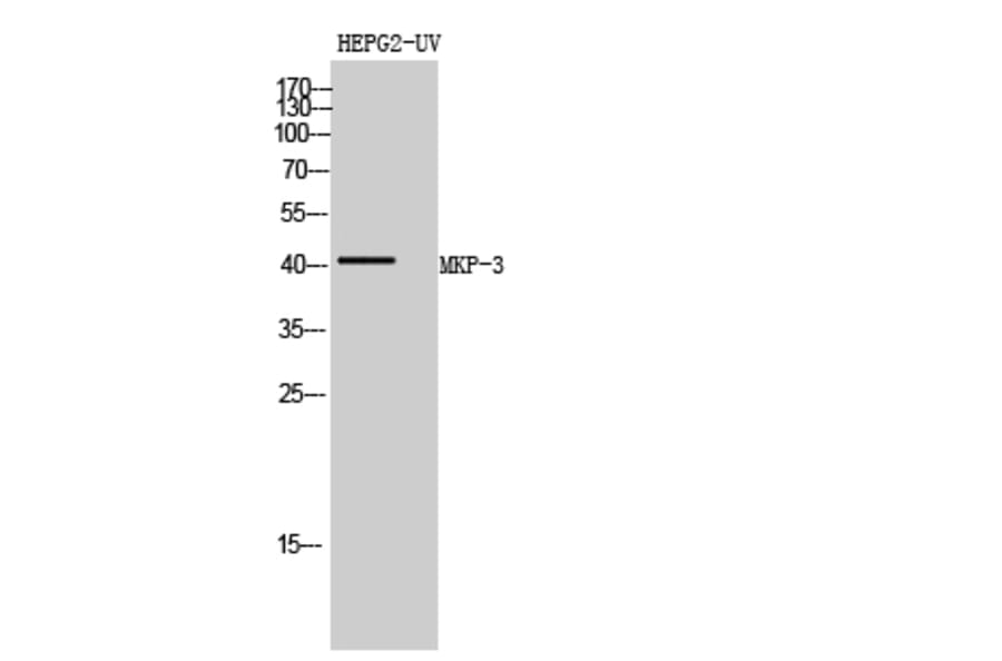 Western blot - MKP-3 Polyclonal Antibody from Signalway Antibody (41149) - Antibodies.com