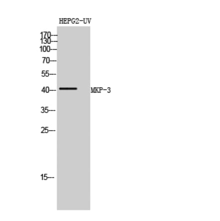 Western blot - MKP-3 Polyclonal Antibody from Signalway Antibody (41149) - Antibodies.com