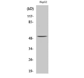 Western blot - MMP-1 Polyclonal Antibody from Signalway Antibody (41152) - Antibodies.com