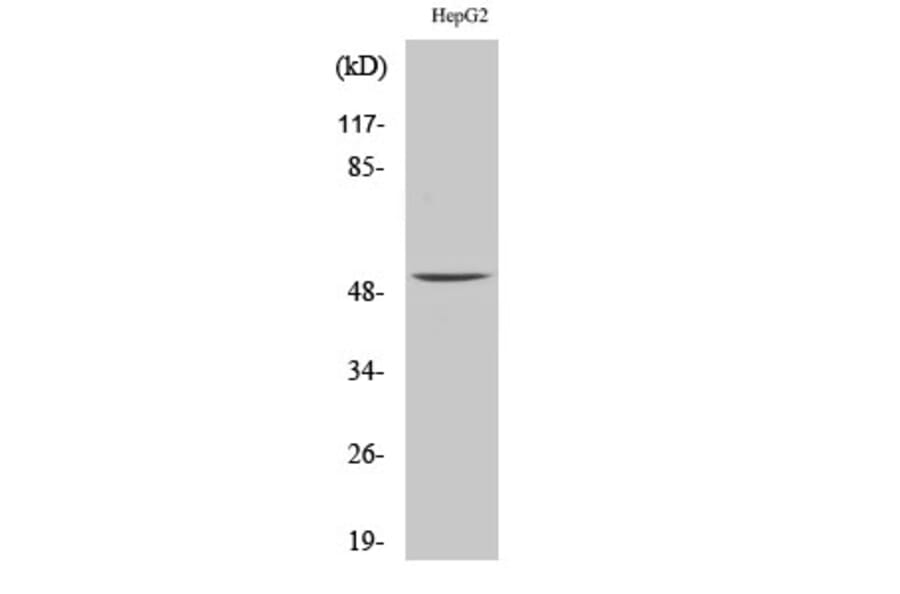 Western blot - MMP-1 Polyclonal Antibody from Signalway Antibody (41152) - Antibodies.com