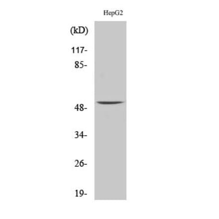 Western blot - MMP-1 Polyclonal Antibody from Signalway Antibody (41152) - Antibodies.com