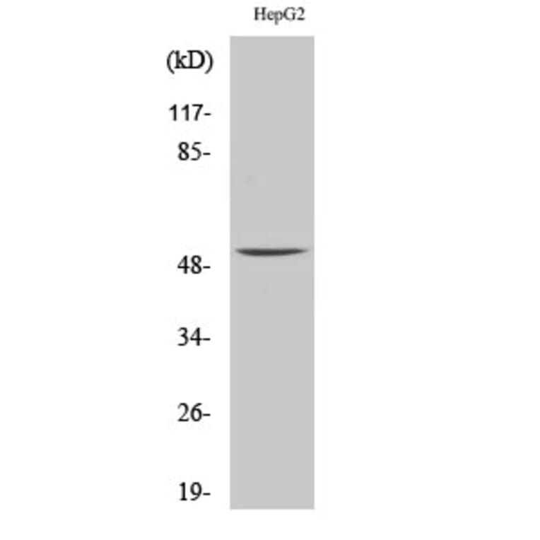 Western blot - MMP-1 Polyclonal Antibody from Signalway Antibody (41152) - Antibodies.com