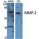 Western blot - MMP-2 Polyclonal Antibody from Signalway Antibody (41156) - Antibodies.com