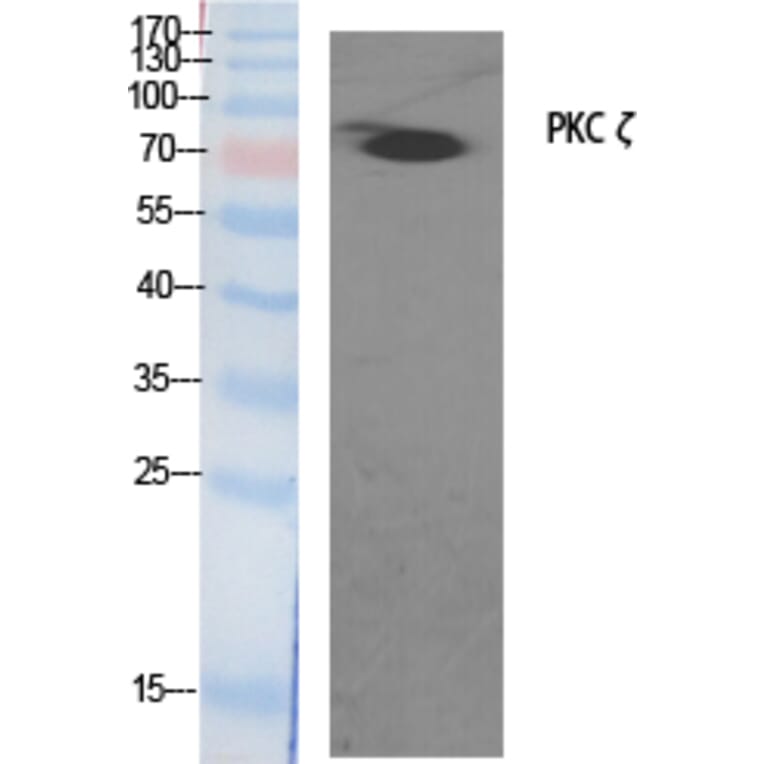 Western blot - PKC ζ Polyclonal Antibody from Signalway Antibody (41349) - Antibodies.com