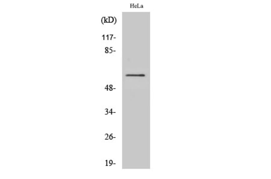 Western blot - Raf-B Polyclonal Antibody from Signalway Antibody (41385) - Antibodies.com