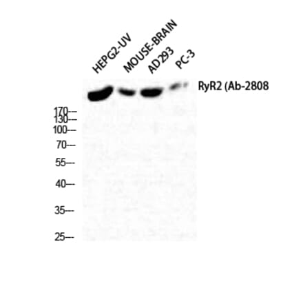 Western blot - RyR-2 Polyclonal Antibody from Signalway Antibody (41420) - Antibodies.com
