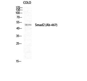 Western blot - Smad2 Polyclonal Antibody from Signalway Antibody (41442) - Antibodies.com