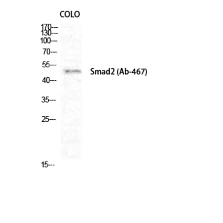 Western blot - Smad2 Polyclonal Antibody from Signalway Antibody (41442) - Antibodies.com