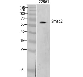 Western blot - Smad2 Polyclonal Antibody from Signalway Antibody (41443) - Antibodies.com