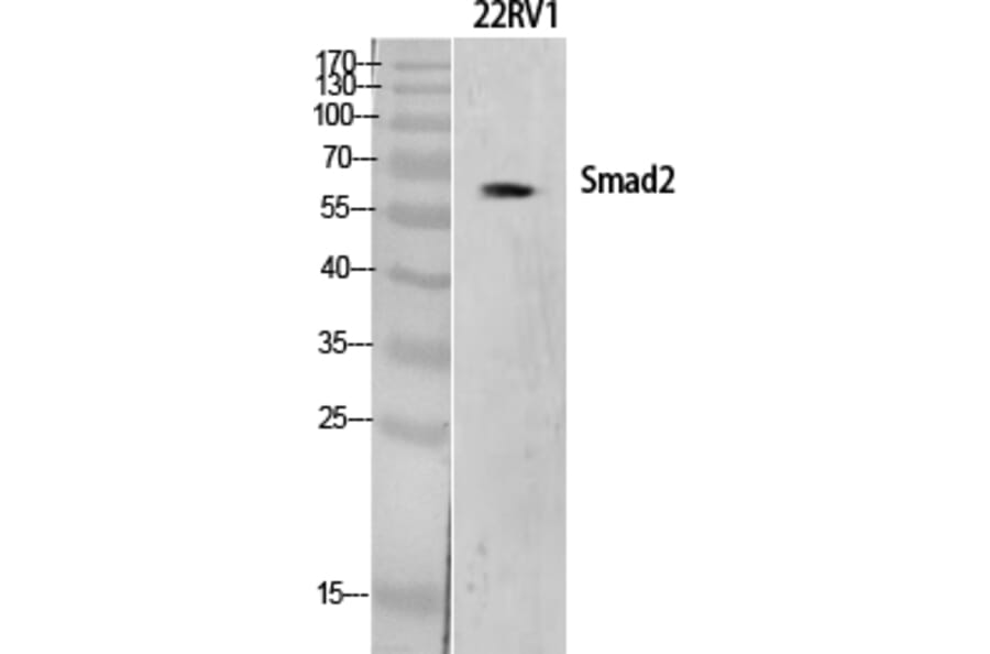Western blot - Smad2 Polyclonal Antibody from Signalway Antibody (41443) - Antibodies.com