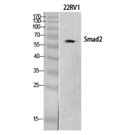 Western blot - Smad2 Polyclonal Antibody from Signalway Antibody (41443) - Antibodies.com