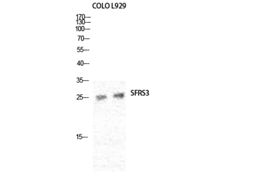 Western blot - SRp20 Polyclonal Antibody from Signalway Antibody (41460) - Antibodies.com