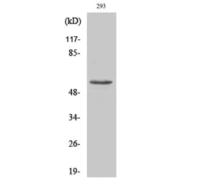 Western blot - MMP-3 Polyclonal Antibody from Signalway Antibody (41468) - Antibodies.com
