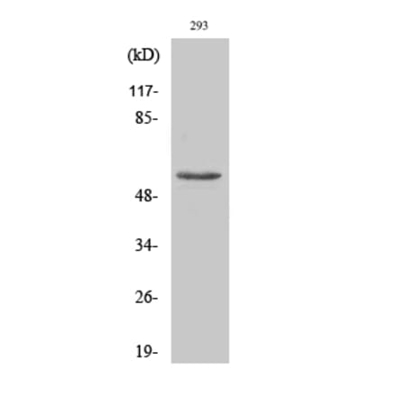 Western blot - MMP-3 Polyclonal Antibody from Signalway Antibody (41468) - Antibodies.com