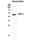 Western blot - MMP-3 Polyclonal Antibody from Signalway Antibody (41468) - Antibodies.com