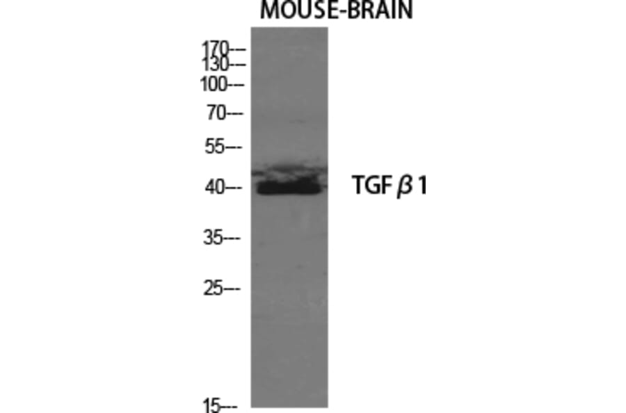 Western blot - TGFβ1 Polyclonal Antibody from Signalway Antibody (41494) - Antibodies.com