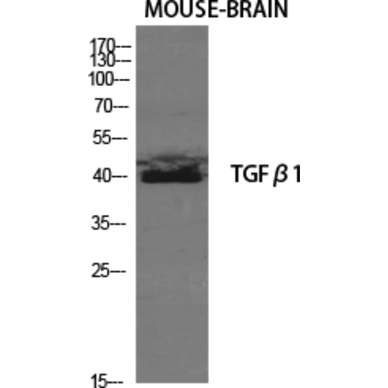 Western blot - TGFβ1 Polyclonal Antibody from Signalway Antibody (41494) - Antibodies.com