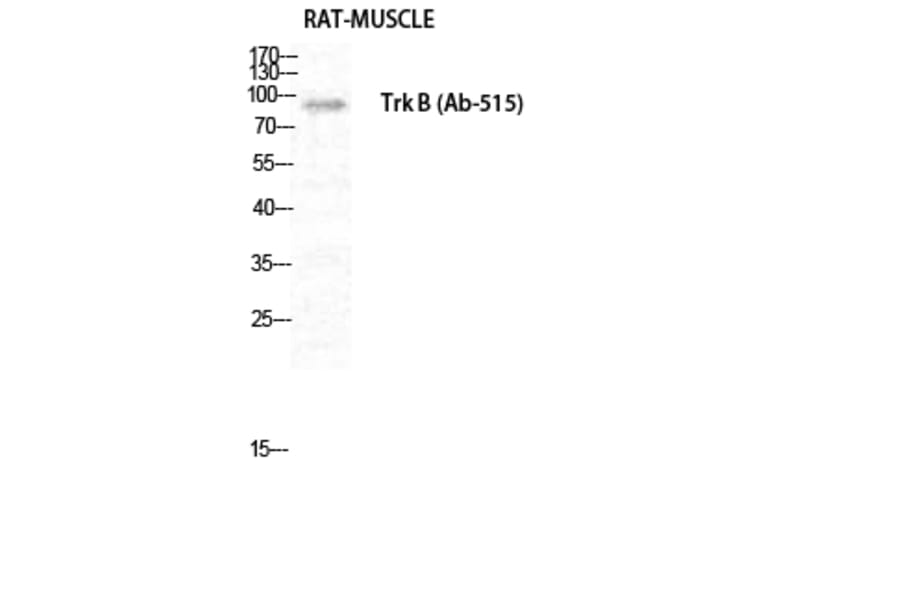 Western blot - Trk B Polyclonal Antibody from Signalway Antibody (41515) - Antibodies.com