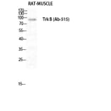 Western blot - Trk B Polyclonal Antibody from Signalway Antibody (41515) - Antibodies.com