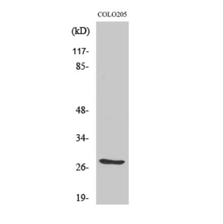 Western blot - TWEAK Polyclonal Antibody from Signalway Antibody (41518) - Antibodies.com