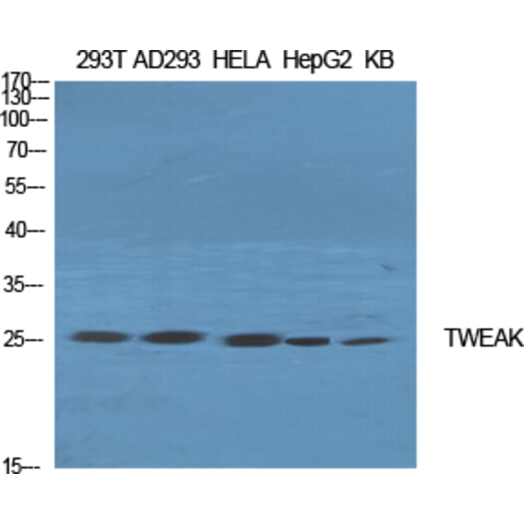 Western blot - TWEAK Polyclonal Antibody from Signalway Antibody (41518) - Antibodies.com