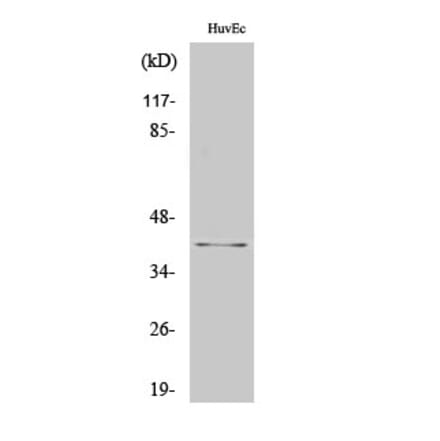Western blot - AIM2 Polyclonal Antibody from Signalway Antibody (40561) - Antibodies.com