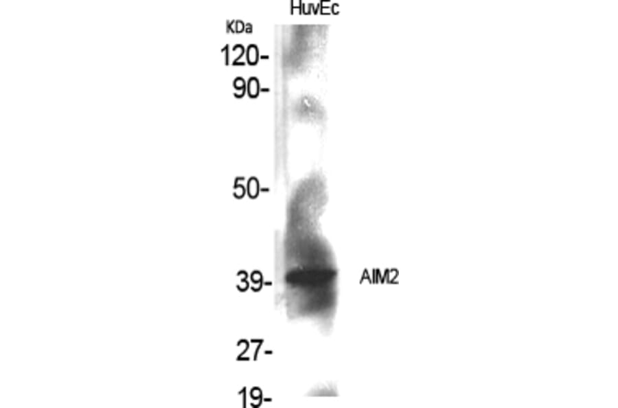 Western blot - AIM2 Polyclonal Antibody from Signalway Antibody (40561) - Antibodies.com