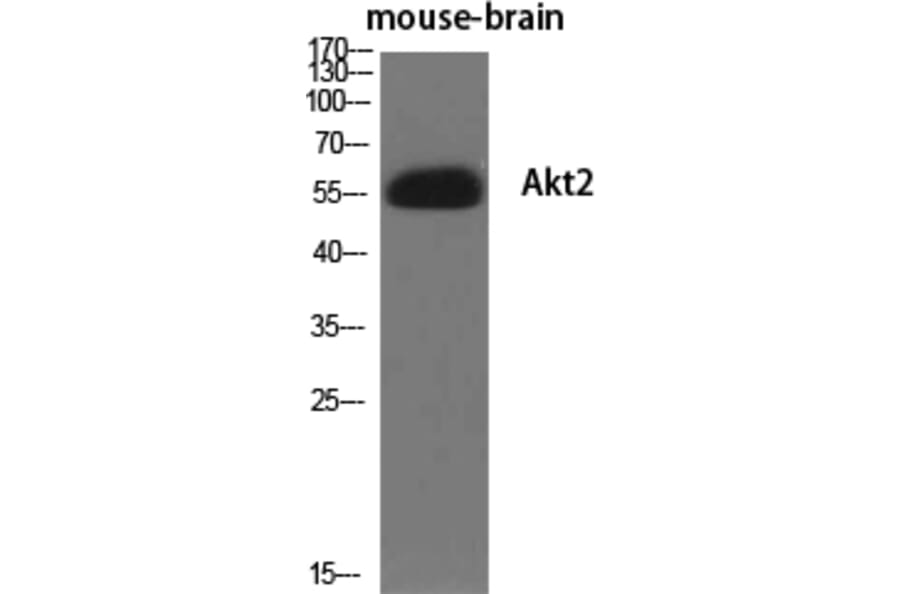 Western blot - Akt2 Polyclonal Antibody from Signalway Antibody (40578) - Antibodies.com
