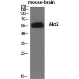 Western blot - Akt2 Polyclonal Antibody from Signalway Antibody (40578) - Antibodies.com