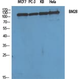 Western blot - BM28 Polyclonal Antibody from Signalway Antibody (40647) - Antibodies.com