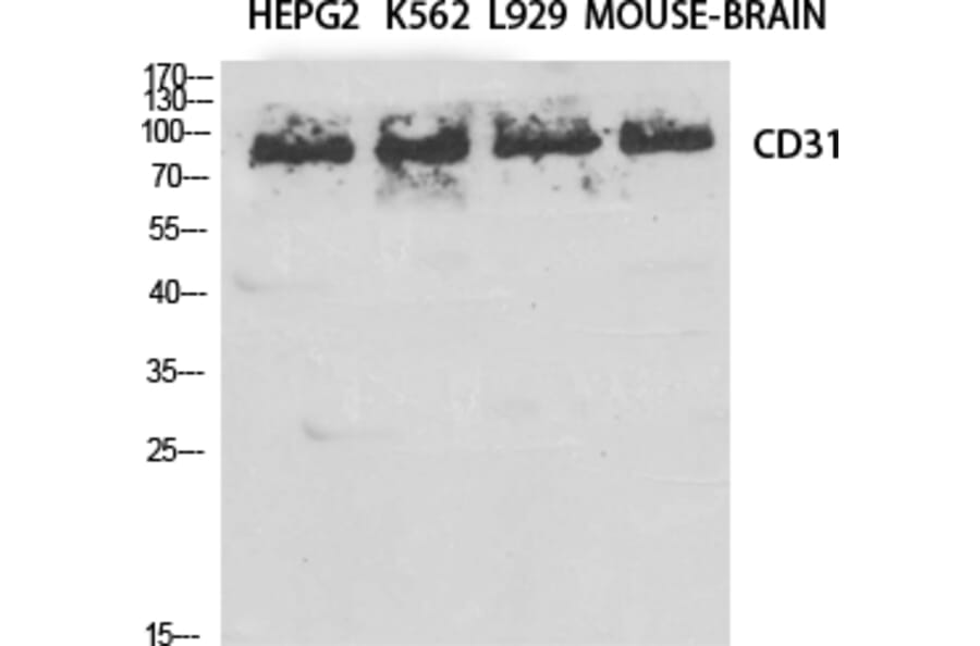 Western blot - CD31 Polyclonal Antibody from Signalway Antibody (40699) - Antibodies.com