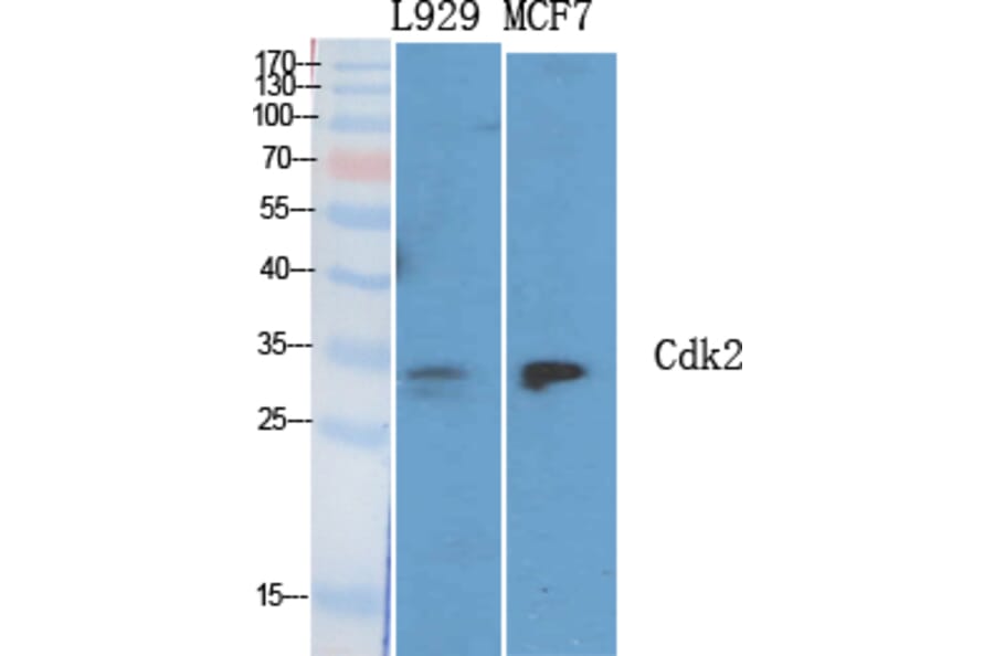 Western blot - Cdk2 Polyclonal Antibody from Signalway Antibody (40719) - Antibodies.com