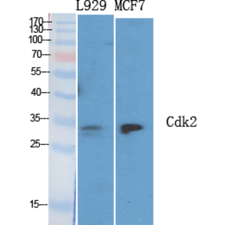 Western blot - Cdk2 Polyclonal Antibody from Signalway Antibody (40719) - Antibodies.com