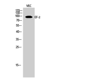 Western blot - EF-2 Polyclonal Antibody from Signalway Antibody (40864) - Antibodies.com