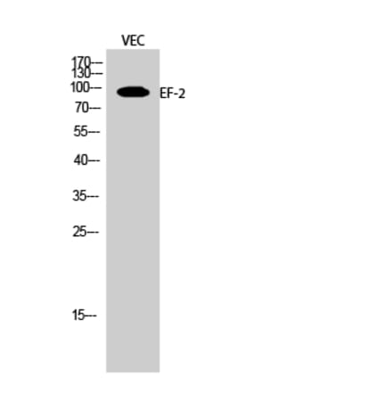 Western blot - EF-2 Polyclonal Antibody from Signalway Antibody (40864) - Antibodies.com