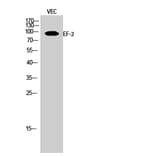 Western blot - EF-2 Polyclonal Antibody from Signalway Antibody (40864) - Antibodies.com