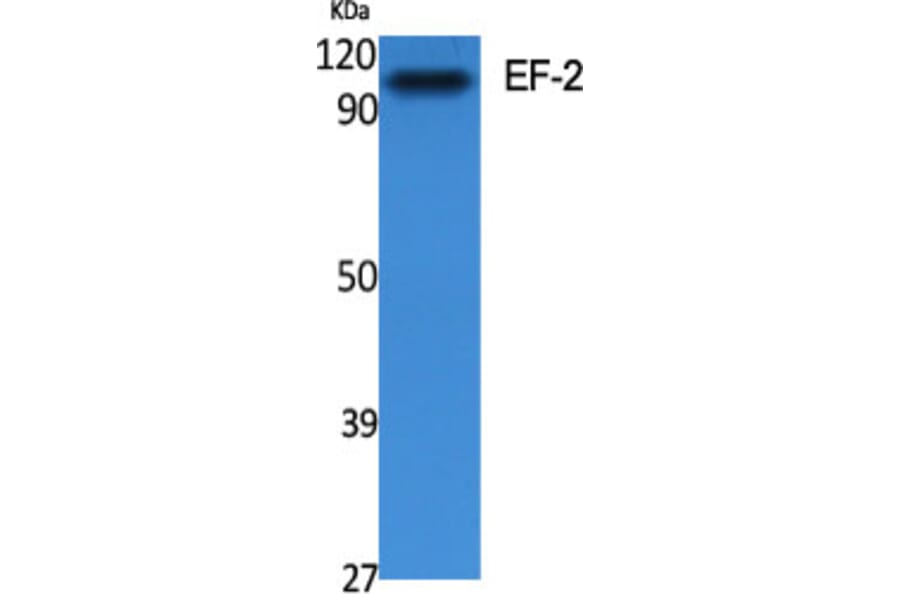 Western blot - EF-2 Polyclonal Antibody from Signalway Antibody (40864) - Antibodies.com
