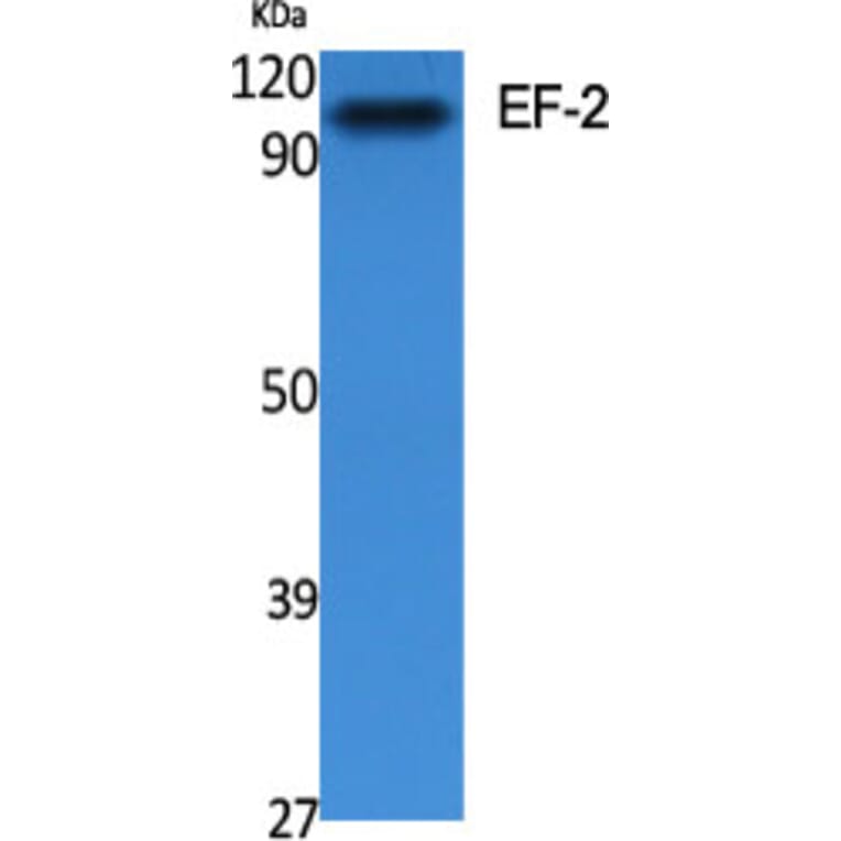 Western blot - EF-2 Polyclonal Antibody from Signalway Antibody (40864) - Antibodies.com