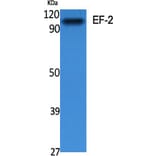 Western blot - EF-2 Polyclonal Antibody from Signalway Antibody (40864) - Antibodies.com