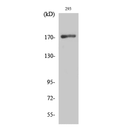 Western blot - EGFR Polyclonal Antibody from Signalway Antibody (40867) - Antibodies.com